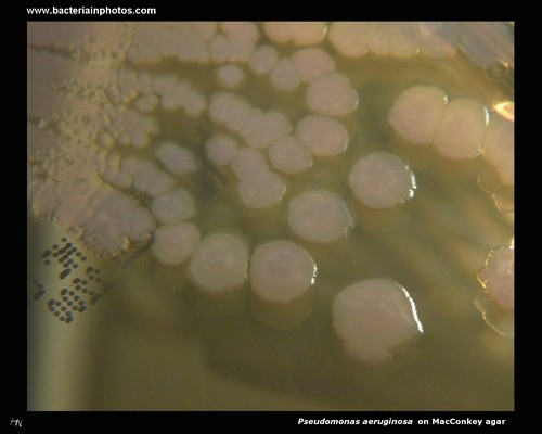 pseudomonas colonies on macconkey